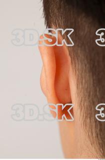 Ear texture of Casey 0001